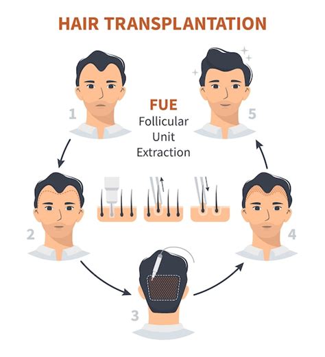 Premium Vector Stages Of Hair Transplantation Fue Follicular Unit