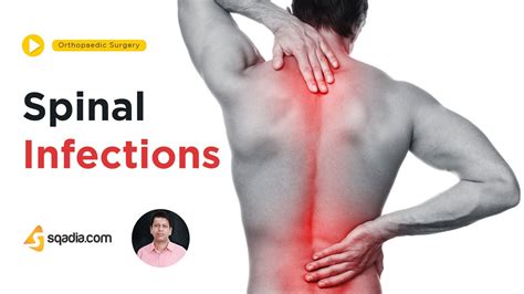 Spinal Infections