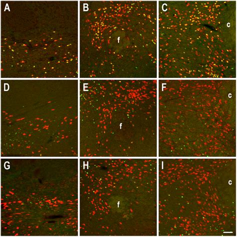 Effect Of Rebound Sleep On The Activity Of Nesfatin1 NUCB2