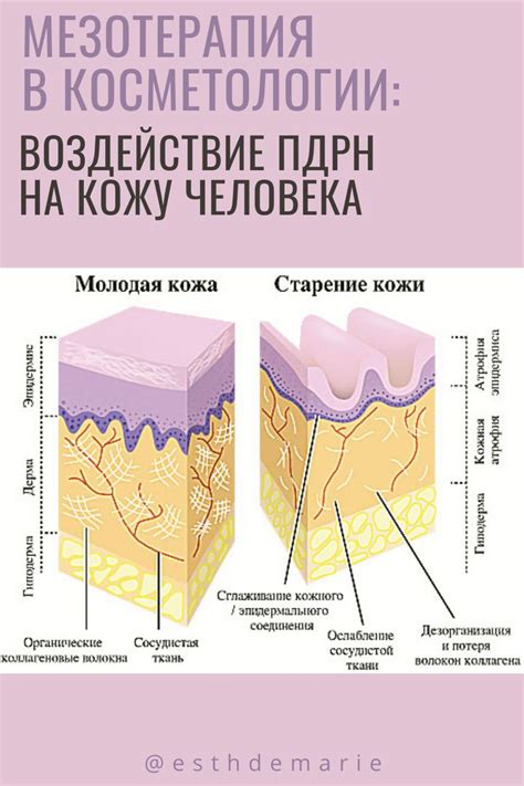 Мезотерапия в косметологии: воздействие ПДРН на кожу | Takeout ...