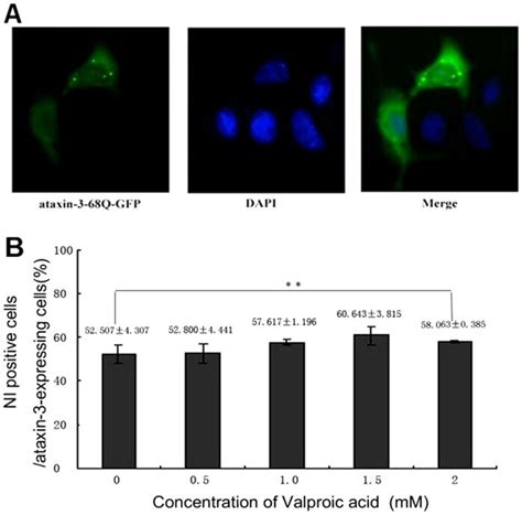 A Fluorescent Microscopy Showing The Expression Of Ataxin Q Gfp