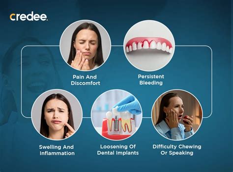 Dental Bone Graft Cost In 2025 With Or Without Insurance