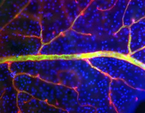 Blood Vessels In The Retina Showing The Endothelial Cells In Red And