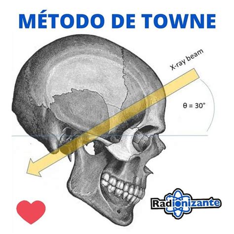 437 curtidas 3 comentários Simon Gonçalves Radiologia