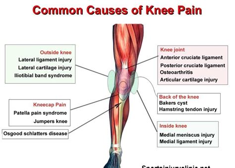 Knee Pain: Where is your knee pain and what could be causing it? These ...