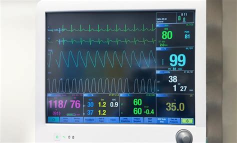 Frecuencia Respiratoria Cómo Medirla