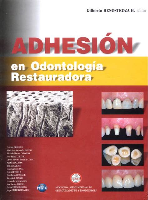 Adhesión en Odontología Restauradora booksmedicos