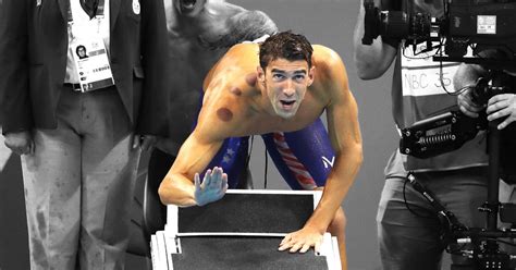 Michael Phelps Gives Cupping a Moment at 2016 Rio Olympics