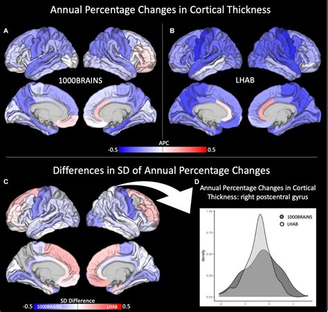 Frontiers Generalizing Longitudinal Age Effects On Brain Structure