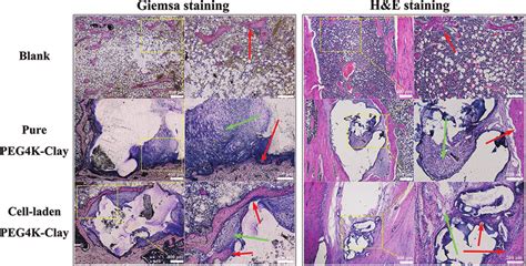 Histological Staining Observations Of The Whole Bone Around The Defects Download Scientific