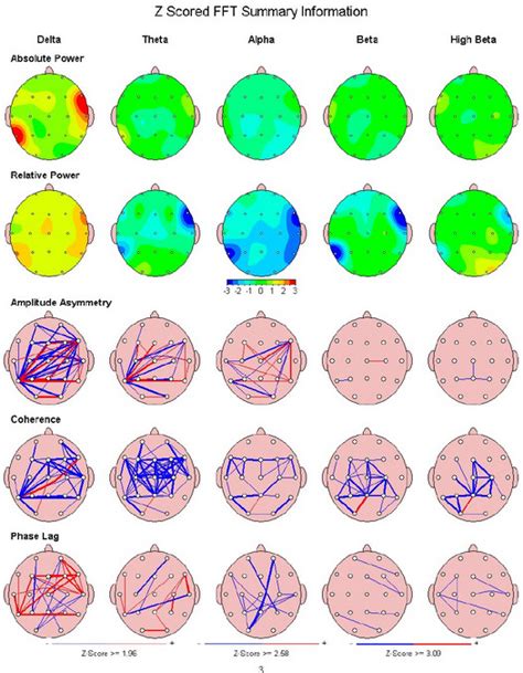 Article What Is A Qeeg Brain Scan In Simple Terms And How Can It