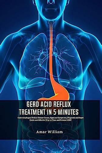 Gerd Acid Reflux Treatment In 5 Minutes Gastroesophageal Reflux