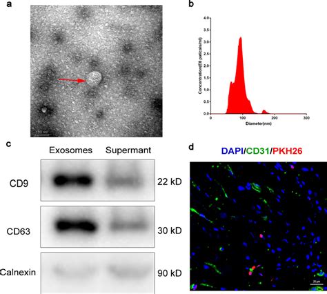 The Identification And Characterization Of Bovine Milk Exosomes A