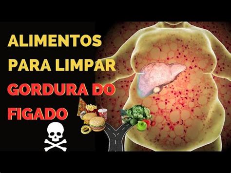 Top 5 alimentos para ligar gordura no fígado e 5 piores alimentos para