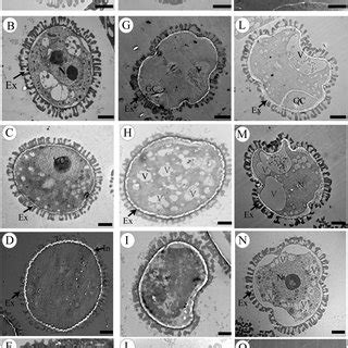 Transmission Electron Micrographs Of Microspores From The Wild Type And