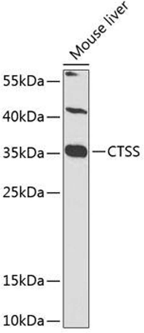 Anti Ctss 抗体 Cab1874 Assay Genie