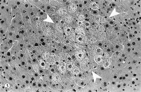 Hydropic Degeneration Area Between Arrow In The Liver Of Rats Treated