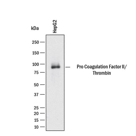 Human Pro Coagulation Factor Ii Thrombin Antibody Mab By R D