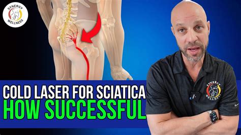 Cold Laser And Sciatica How Successful Is It Youtube