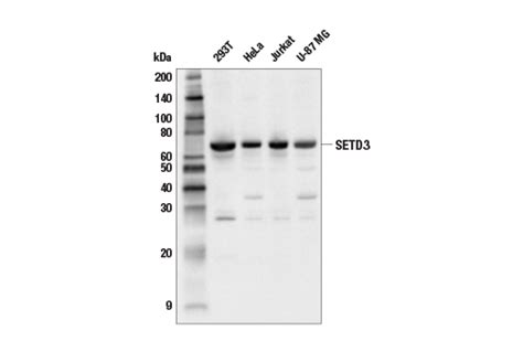 Setd3 Antibody Cell Signaling Technology