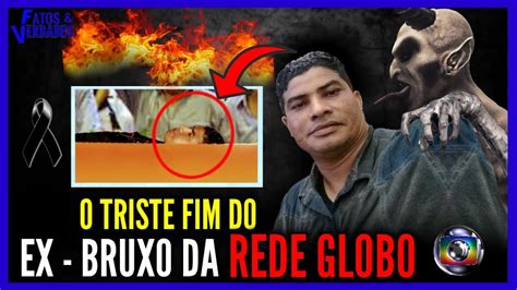 O Triste Fim Do Ex Bruxo Da Globo Aldo Nascimento Youtube