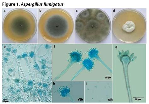 Composting And Aspergillus Fumigatus — A Re-Emergent Issue? | BioCycle