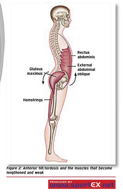 Exercises To Fix Anterior Pelvic Tilt Physical Living