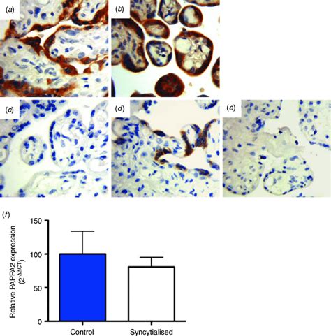 Pregnancy Associated Plasma Protein A Pappa Protein Is Localised To