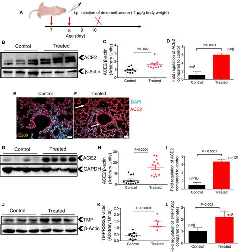 Frontiers Differential Effects Of Age Sex And Dexamethasone Therapy On Ace2 Tmprss2