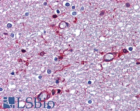 Anti App Beta Amyloid Precursor Antibody Rabbit Anti Human Lsbio