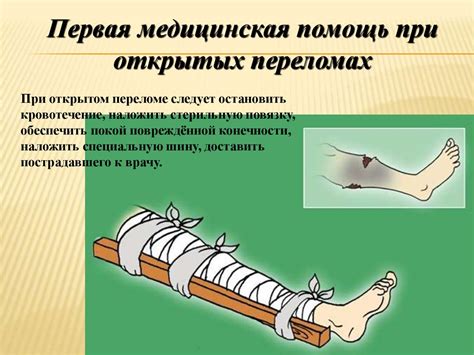 Понятие травм и их виды - презентация онлайн