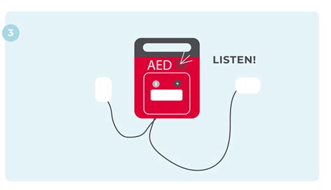 How To Use An Aed On A Pregnant Woman Infographic Heartsmart