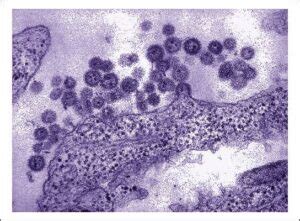 What Is The Machupo Virus: What Are The Symptoms?