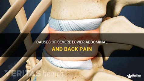 Causes Of Severe Lower Abdominal And Back Pain Medshun