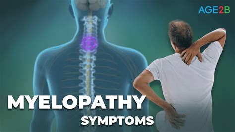 Myelopathy | Symptoms - AGE2B