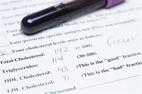 What Does Blood Test Cholesterol Mean at Randall Graves blog