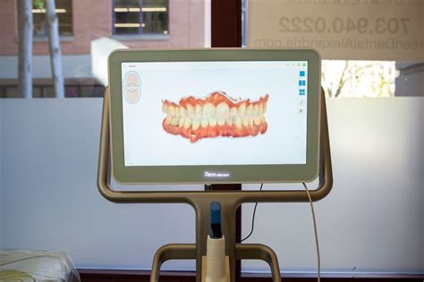 High Tech Dental Office In Alexandria Arlington Va Dentists With