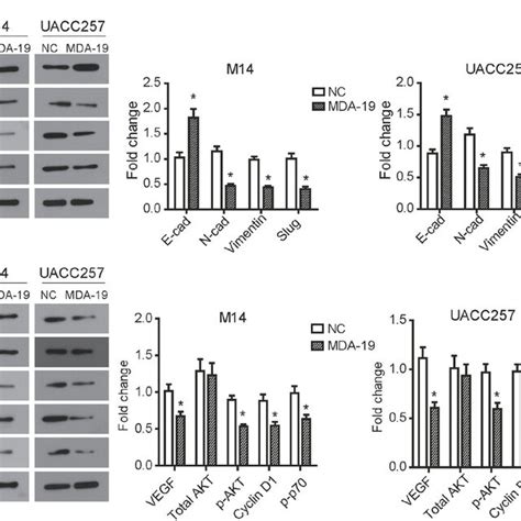 MDA 19 Suppresses EMT Process And PI3K Akt Pathway In Melanoma Cells