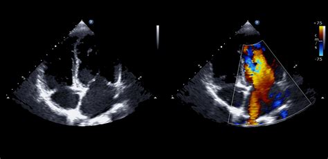 Echocardiography | Cooley Dickinson Radiology & Imaging