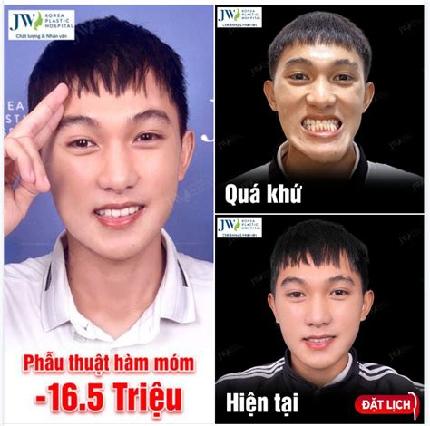 Ch Ng Trai Gen Z P Nh Hot Boy Sau Ph U Thu T H M M M T I Jw