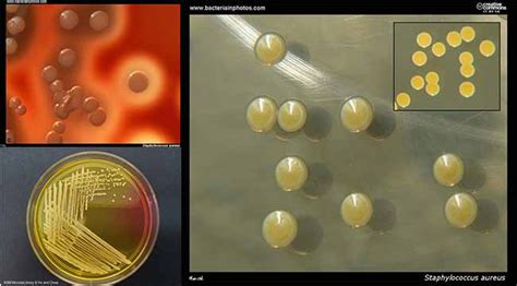 Cultural And Biochemical Characteristics Of Staphylococcus Aureus