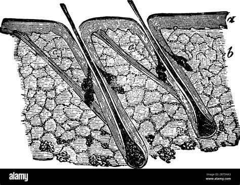 This Illustration Represents Section Of Skin Showing Hairs And