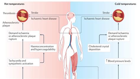 Umsom Cardiovascular Fellow And Colleagues Provide Overview Of Impacts