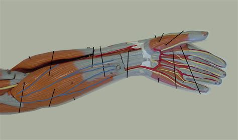 Lower Left Arm & Hand Muscle Diagram | Quizlet