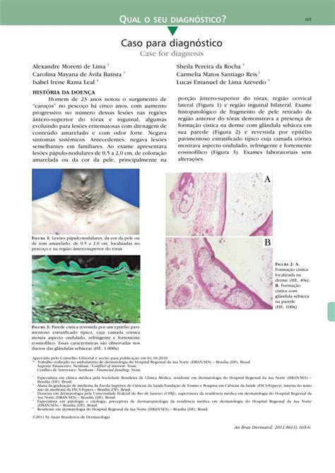 Pdf Case For Diagnosis Steatocystoma Multiplex