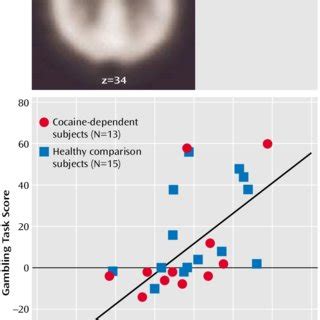 Areas Of Increased Resting Regional Cerebral Blood Flow RCBF In