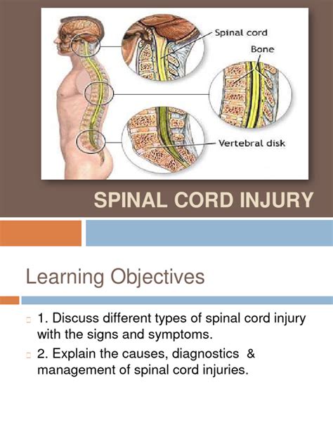 Spinal Cord Injury | PDF