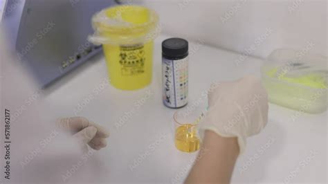 Reagent Strip For Urinalysis Routine Urinalysis Check Up Analysis In