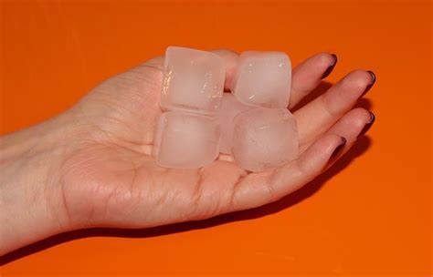 Ice Burn Causes Symptoms And Treatment