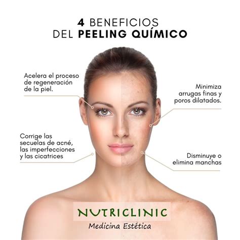 Peeling Químico Facial Y Sus Beneficios